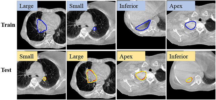 Fig. 11.