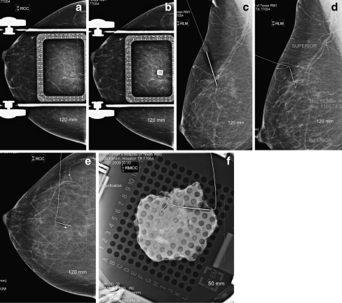 Fig 1