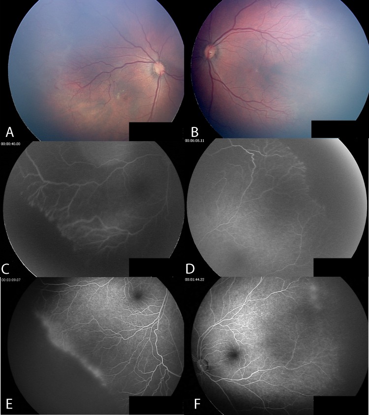 Figure 4