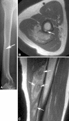 Fig. 5A–C