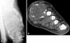 Fig. 2A–B