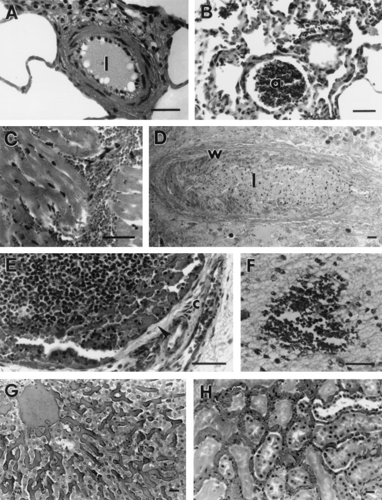 FIG. 6