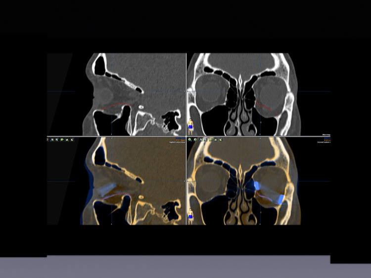 Figure 3.