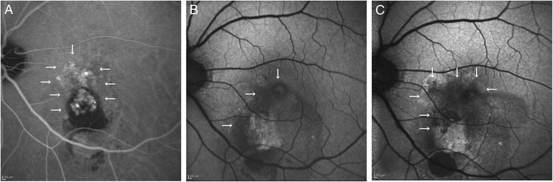 Fig. 2