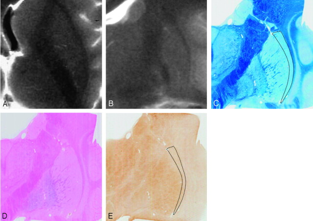 Fig 3.