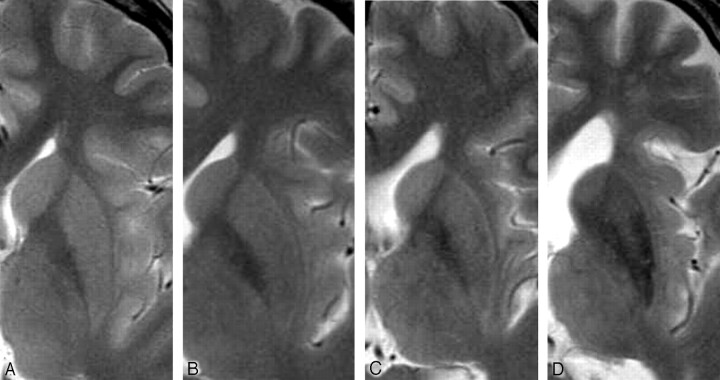 Fig 1.