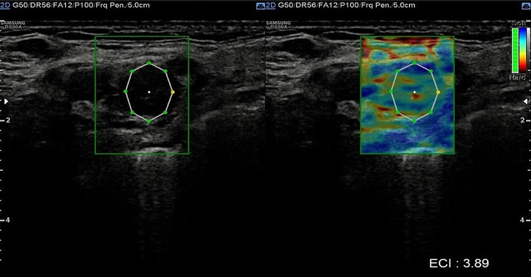 Fig. 3