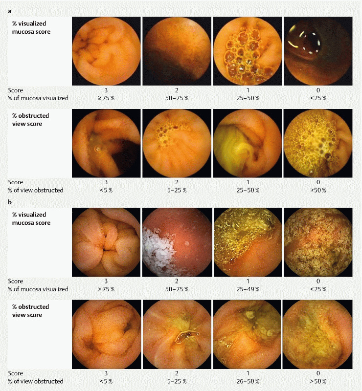 Fig. 1