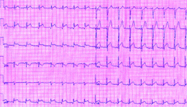 Figure 1  