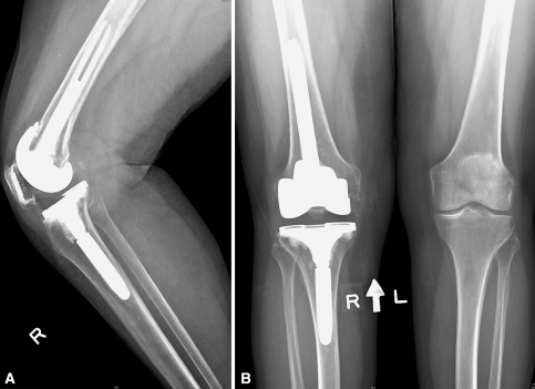 Fig. 3A–B