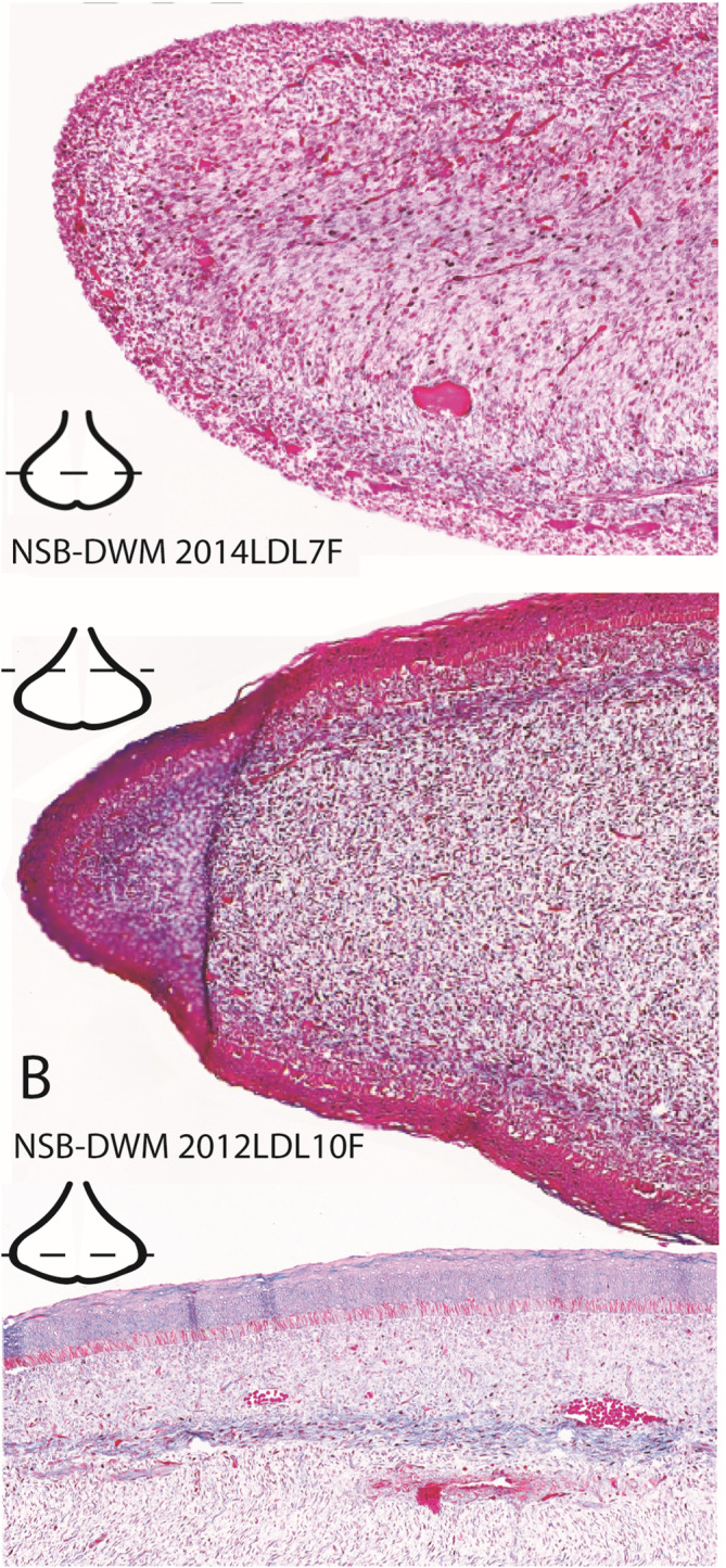 FIGURE 3