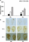 The leaves of Arabidopsis Col-0 were inoculated with Pseudomonas syringae pv. tomato DC3000 and incubated under the exposure of white light (WL) or green (GL) light at an intensity of 100 µmol m−2 s−1. (A) (H₂O₂) was quantified by measuring absorbance at 390 nm. Data represent the mean ± SD from three biological replicates per treatment, and * indicates significant difference between WL and GL. (B) The accumulation was analyzed by DAB staining.