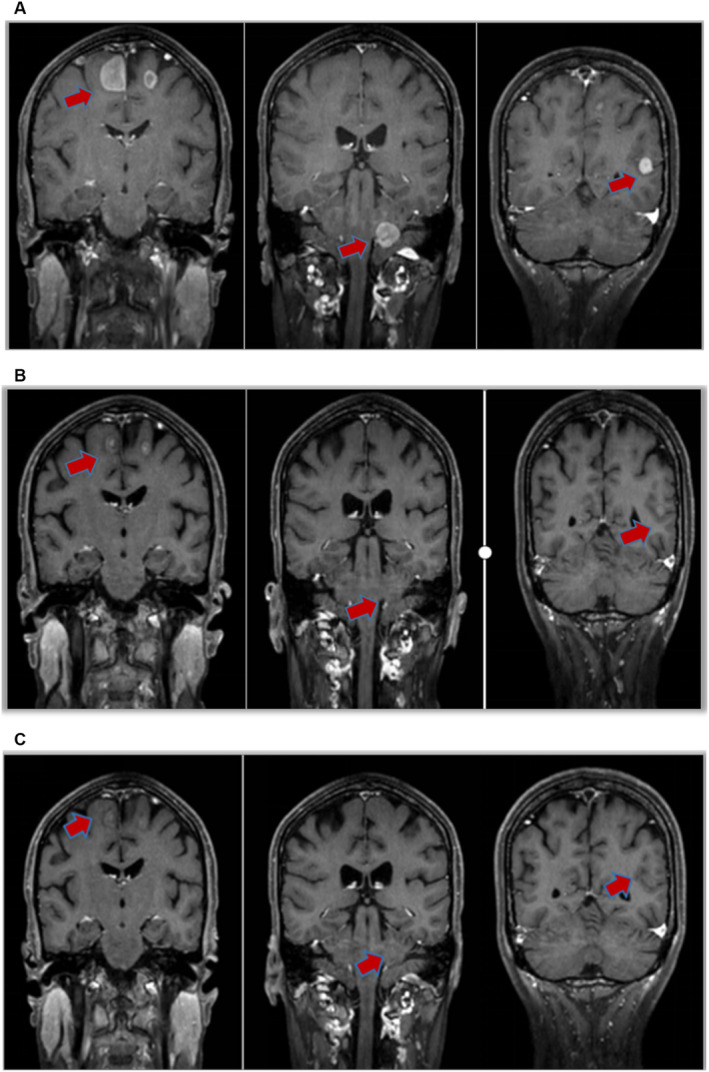 FIGURE 2