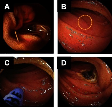 Fig. 2