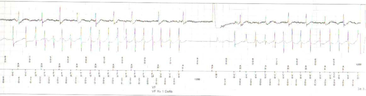 Fig. 2