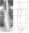 Fig. 1-1