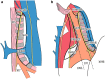 Fig. 1-7