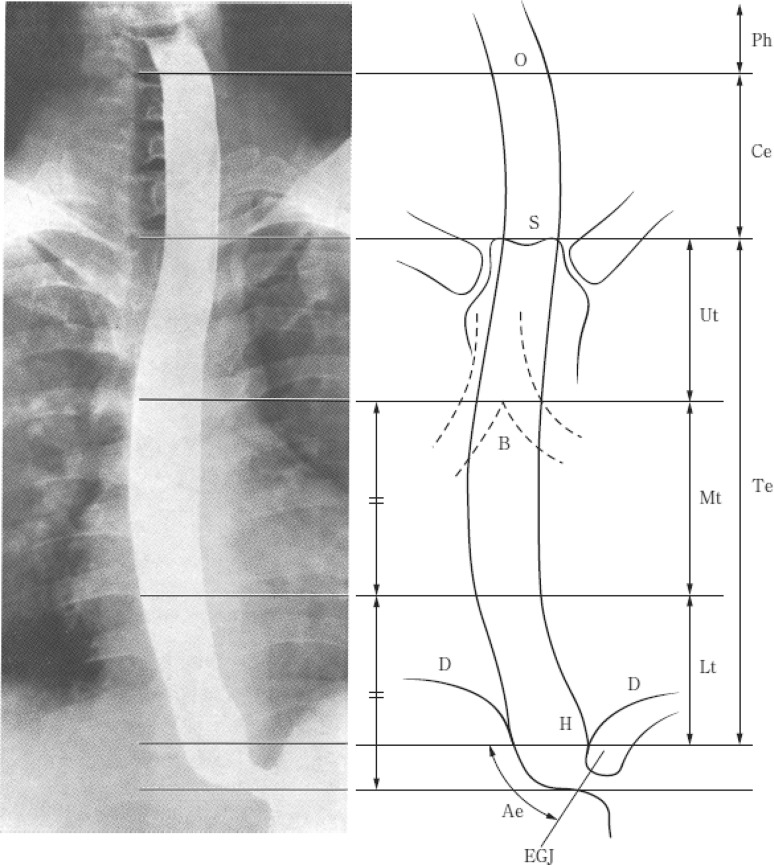 Fig. 1-1