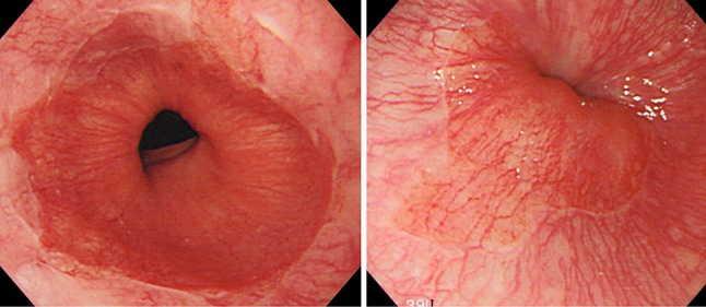 Fig. 1-19