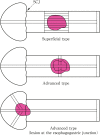 Fig. 1-15