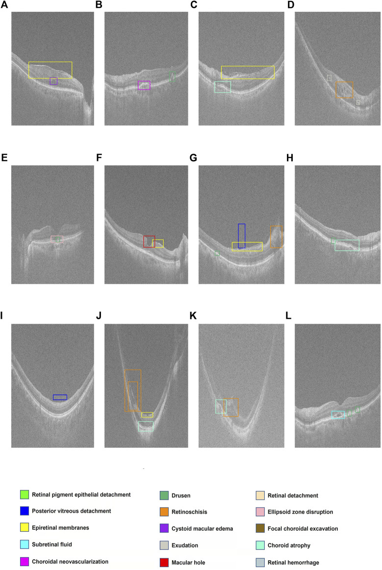 FIGURE 3