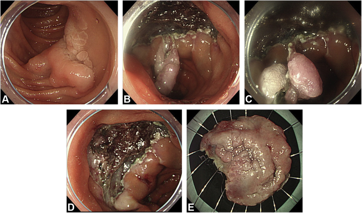 Figure 2