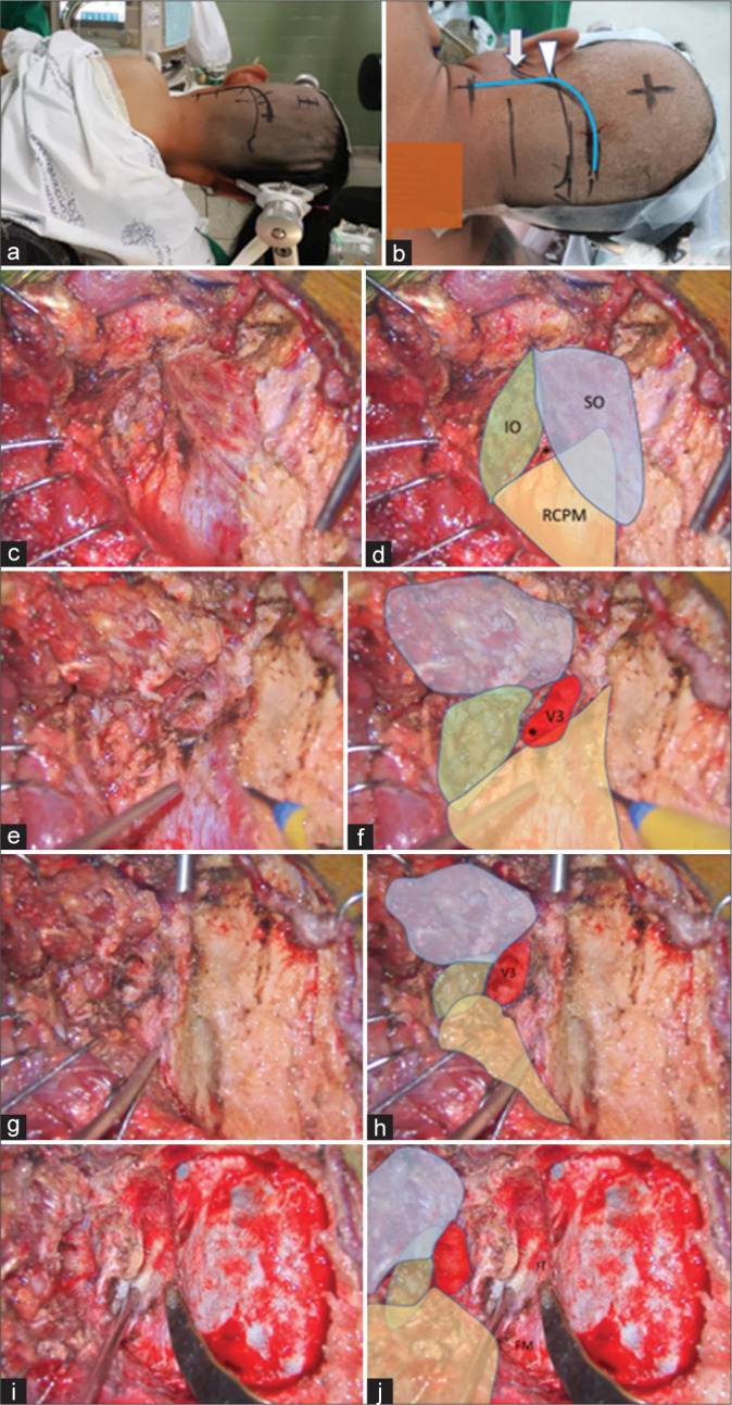 Figure 7: