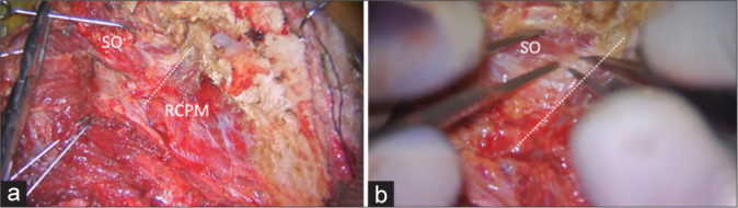 Figure 2: