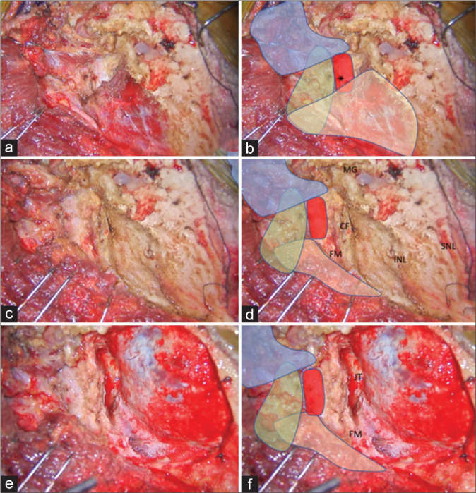 Figure 3: