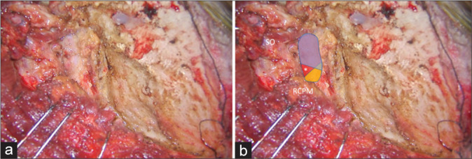 Figure 6: