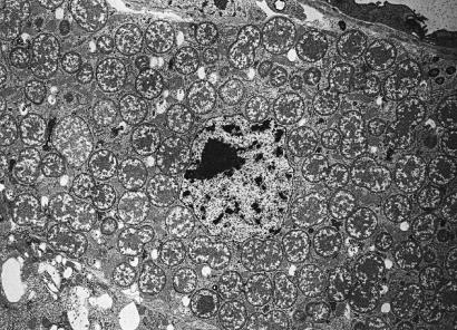 Electron micrograph of Proteobacteria in eukaryotic cell