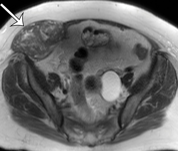 Figure 10c.