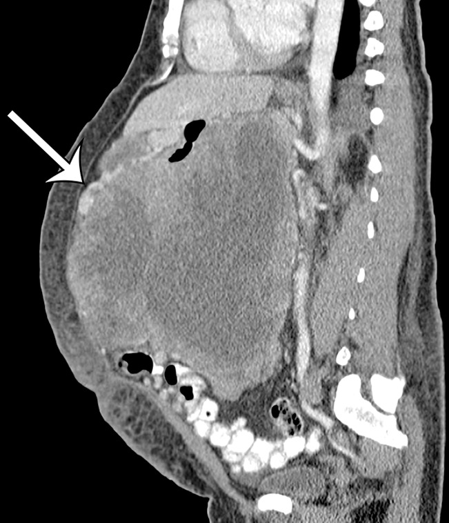 Figure 13c.