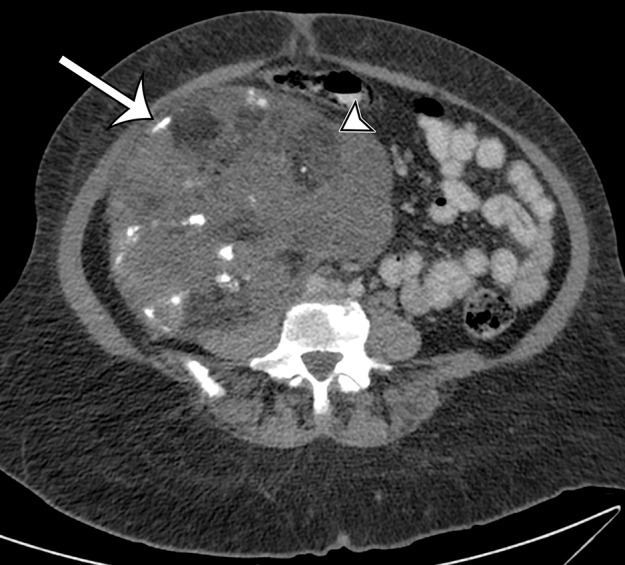 Figure 6c.