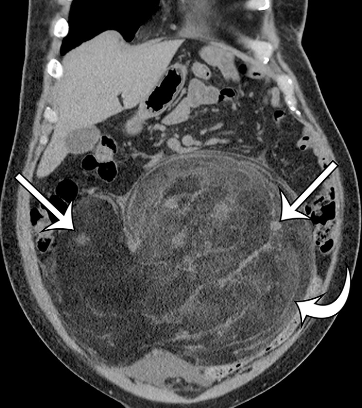 Figure 3b.