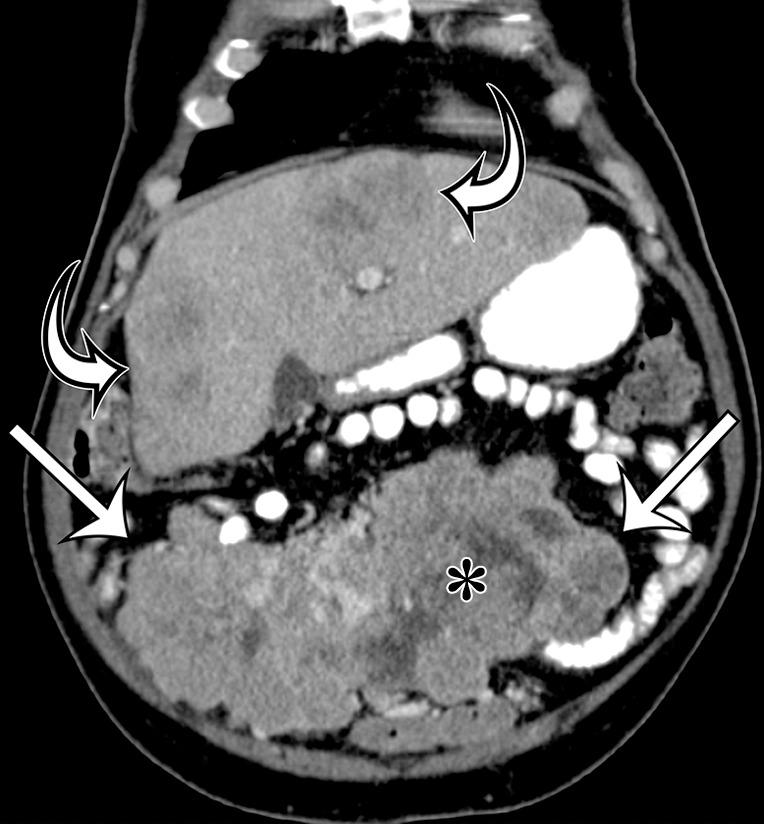 Figure 11b.