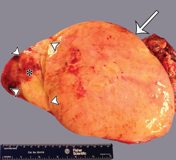 Figure 5b.