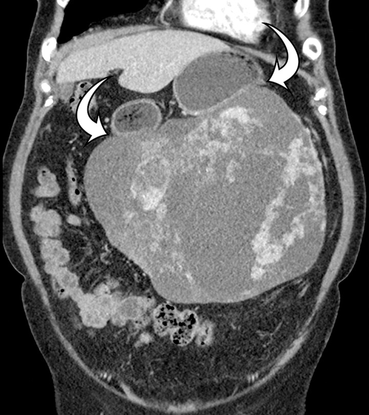 Figure 14b.