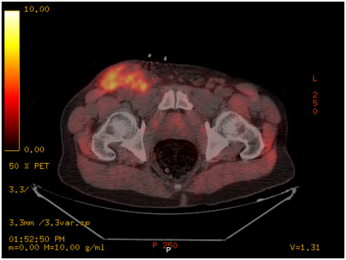 Figure 2