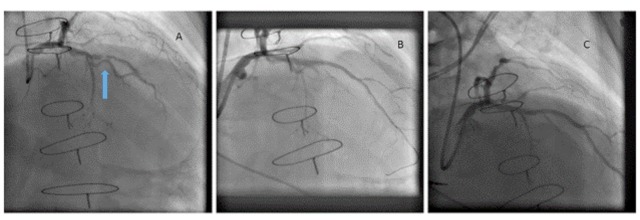 Fig. (1)