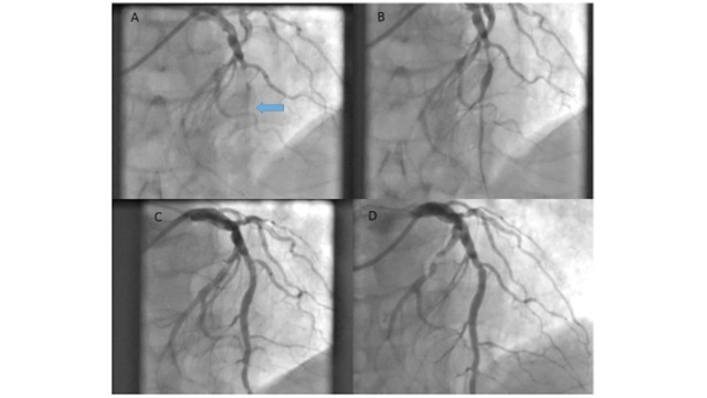 Fig. (3)