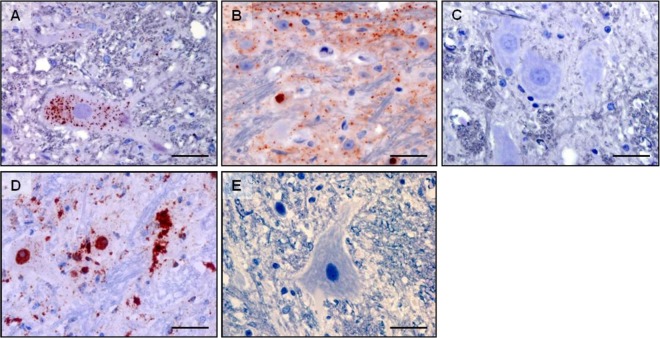 Fig 2