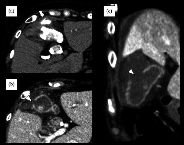 FIGURE 3