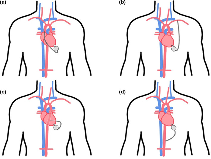 FIGURE 4