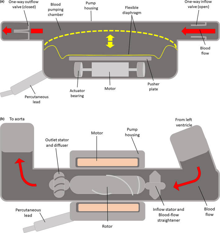 FIGURE 1