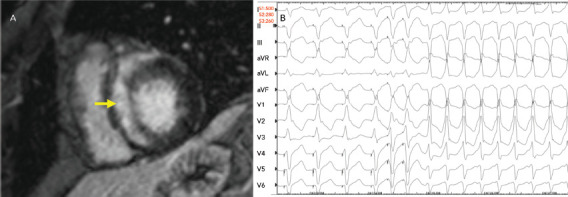 Figure 4: