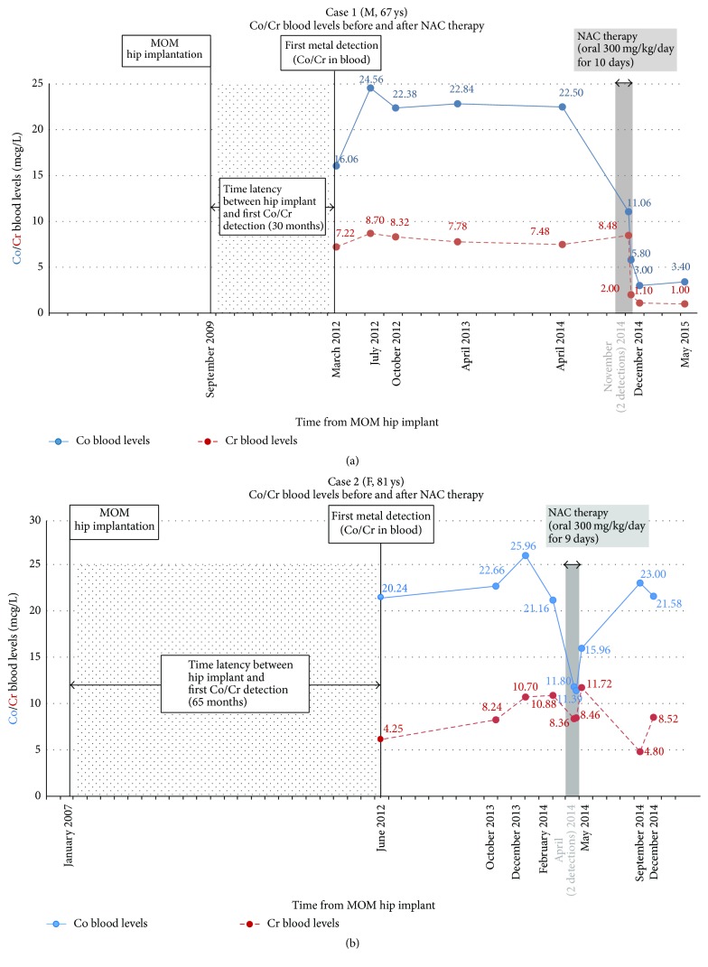 N-Acetyl-Cysteine as Effective and Safe Chelating Agent in Metal-on ...