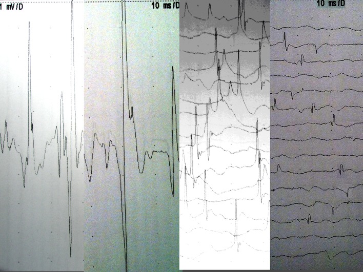 Fig. 3