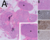 Fig. 14