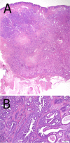 Fig. 16